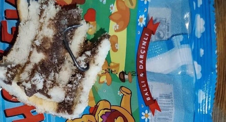 Uşaq peçenyesinin içindən dəmir parçası çıxıb? - FOTOLAR